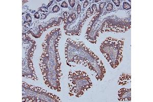IHC analysis of DDR1 using anti-DDR1 antibody (ABIN7601407). (DDR1 抗体  (AA 341-909))