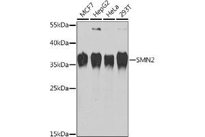 Western blot analysis of extracts of various cell lines, using SMN2 Rabbit pAb (ABIN6127949, ABIN6148136, ABIN6148139 and ABIN6218739) at 1:1000 dilution. (SMN2 抗体  (AA 1-197))