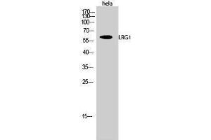 Western Blotting (WB) image for anti-Leucine-Rich alpha-2 Glycoprotein 1 (LRG1) (C-Term) antibody (ABIN3185409) (LRG1 抗体  (C-Term))