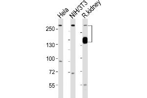 All lanes : Anti-SPTAN1 Antibody (Center) at 1:1000 dilution Lane 1: Hela whole cell lysates Lane 2: NIH/3T3 whole cell lysates Lane 3: rat kidney lysates Lysates/proteins at 20 μg per lane. (SPTAN1 抗体  (AA 977-991))