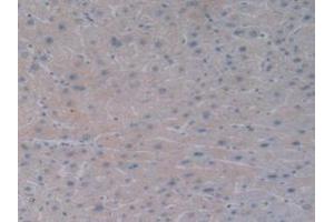 Detection of BMP10 in Human Liver Tissue using Monoclonal Antibody to Bone Morphogenetic Protein 10 (BMP10) (BMP10 抗体  (AA 315-424))