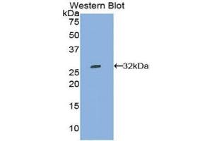 Western Blotting (WB) image for anti-Tryptophanyl-tRNA Synthetase (WARS) (AA 247-458) antibody (ABIN1860957) (WARS 抗体  (AA 247-458))