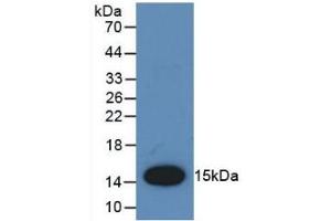Detection of Recombinant MCP1, Rat using Polyclonal Antibody to Monocyte Chemotactic Protein 1 (MCP1) (CCL2 抗体  (AA 24-148))