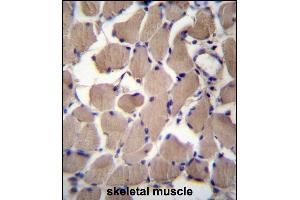 Immunohistochemistry (Paraffin-embedded Sections) (IHC (p)) image for anti-phosphofurin Acidic Cluster Sorting Protein 2 (PACS2) (AA 642-671), (C-Term) antibody (ABIN657066)
