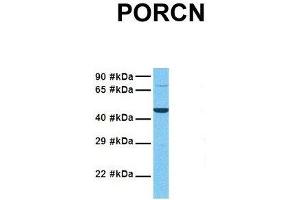 Western Blotting (WB) image for anti-Porcupine Homolog (PORCN) (N-Term) antibody (ABIN2783888)