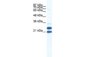 TRIM34 antibody used at 0. (TRIM34 抗体  (N-Term))