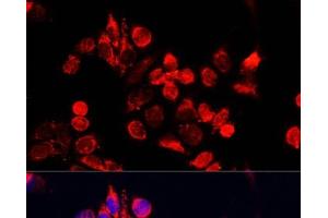 Immunofluorescence analysis of HeLa cells using NFE2L1 Polyclonal Antibody at dilution of 1:100. (NFE2L1 抗体)
