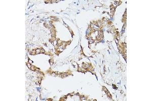 Immunohistochemistry (IHC) image for anti-Heat Shock 70kDa Protein 8 (HSPA8) (AA 1-300) antibody (ABIN3016124)