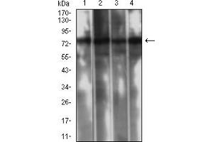 Western Blotting (WB) image for anti-Calpain 1, Large Subunit (CAPNL1) (AA 501-714) antibody (ABIN7193418)