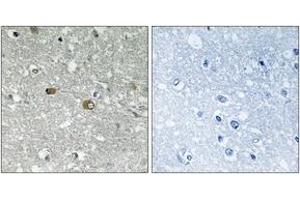 Immunohistochemistry analysis of paraffin-embedded human brain tissue, using PIGH Antibody. (PIGH 抗体  (AA 137-186))