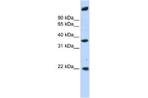 WB Suggested Anti-SSBP3 Antibody Titration: 0. (SSBP3 抗体  (Middle Region))