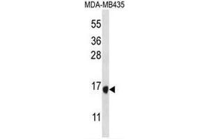 TAC4 Antibody (C-term) western blot analysis in MDA-MB435 cell line lysates (35µg/lane). (Tachykinin 4 抗体  (C-Term))