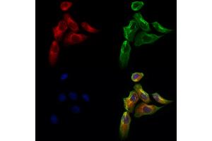 ABIN6260974 and ABIN6273103 staining Hela cells by IF/ICC. (Coq7 抗体  (Internal Region))