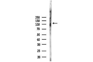 anti-Actin Filament Associated Protein 1 (AFAP1) (N-Term) antibody