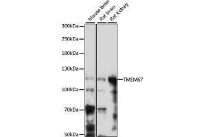 Western blot analysis of extracts of various cell lines, using TMEM67 antibody (ABIN7270970) at 1:1000 dilution. (TMEM67 抗体  (AA 780-940))