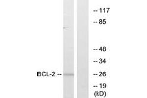 Western blot analysis of extracts from MCF7 cells, treated with Etoposide, using BCL-2 (Ab-56) Antibody. (Bcl-2 抗体  (AA 26-75))