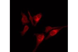 ABIN6275845 staining Hela by IF/ICC. (HUNK 抗体  (Internal Region))