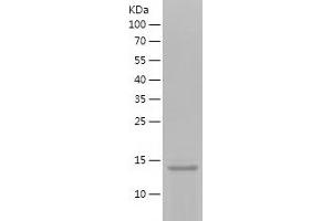 KISS1 Protein (AA 20-110) (His tag)