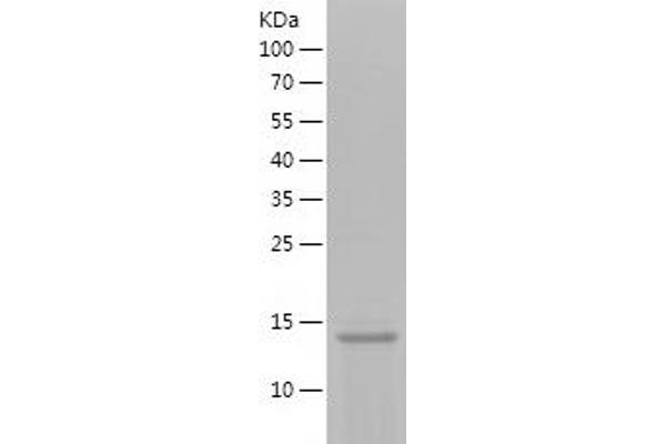 KISS1 Protein (AA 20-110) (His tag)