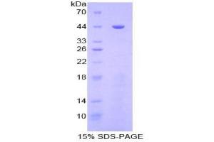 SDS-PAGE analysis of Human Golgi Protein 73 Protein. (GOLM1 蛋白)