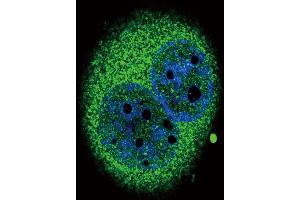 Confocal immunofluorescent analysis of IRF5 Antibody (N-term) (ABIN389333 and ABIN2839445) with A549 cell followed by Alexa Fluor? (IRF5 抗体  (N-Term))