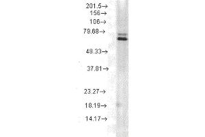 Western Blot analysis of Rat skeletal muscle tissue lysate showing detection of Hsp70 protein using Mouse Anti-Hsp70 Monoclonal Antibody, Clone 5A5 . (HSP70 抗体  (HRP))