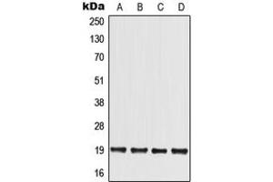 Western blot analysis of MED30 expression in HCT116 (A), HEK293T (B), Raw264. (MED30 抗体  (Center))