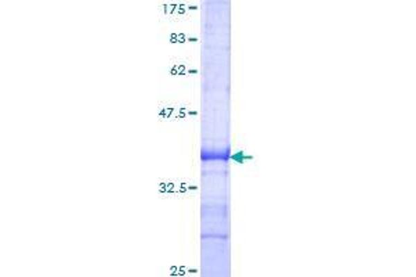SCMH1 Protein (AA 404-502) (GST tag)