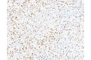 Immunohistochemistry (IHC) image for anti-Spleen Focus Forming Virus (SFFV) Proviral Integration Oncogene Spi1 (SPI1) (AA 220-270) antibody (ABIN7455166)