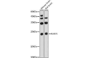 Western blot analysis of extracts of various cell lines, using R antibody (ABIN6133143, ABIN6146576, ABIN6146578 and ABIN6224057) at 1:1000 dilution. (RAB35 抗体  (AA 1-201))