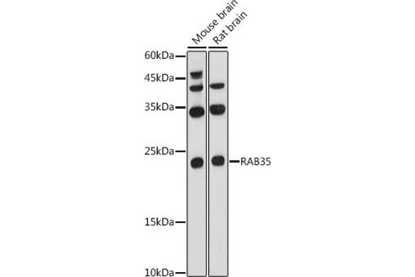 RAB35 抗体  (AA 1-201)