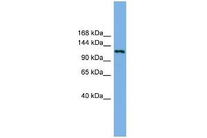 WB Suggested Anti-EIF4ENIF1 Antibody Titration: 0. (EIF4ENIF1 抗体  (N-Term))