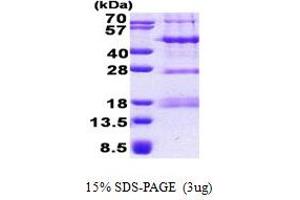 SDS-PAGE (SDS) image for PHD Finger Protein 13 (PHF13) (AA 1-300) protein (His tag) (ABIN6387231) (PHF13 Protein (AA 1-300) (His tag))