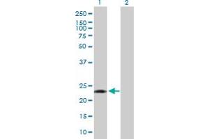 Western Blot analysis of PCTP expression in transfected 293T cell line by PCTP MaxPab polyclonal antibody. (PCTP 抗体  (AA 1-214))