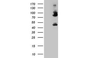Image no. 3 for anti-Coagulation Factor XIII, A1 Polypeptide (F13A1) antibody (ABIN1498152) (F13A1 抗体)