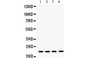 Western Blotting (WB) image for anti-Non-Metastatic Cells 1, Protein (NM23A) Expressed in (NME1) (AA 26-58), (N-Term) antibody (ABIN3043572) (NME1 抗体  (N-Term))