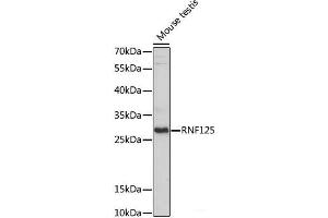 Western blot analysis of extracts of Mouse testis using RNF125 Polyclonal Antibody at dilution of 1:1000. (RNF125 抗体)