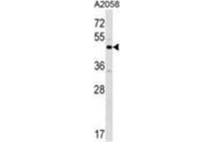 XKR3 Antibody (C-term) western blot analysis in A2058 cell line lysates (35 µg/lane).