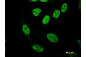 Immunofluorescence of monoclonal antibody to PASD1 on HeLa cell.
