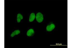 Immunofluorescence of purified MaxPab antibody to METTL3 on HeLa cell. (METTL3 抗体  (AA 1-580))