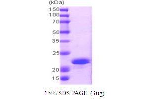 SDS-PAGE (SDS) image for Protein Phosphatase 1, Regulatory (Inhibitor) Subunit 14A (PPP1R14A) (AA 1-147) protein (His tag) (ABIN667711)