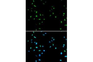 Immunofluorescence analysis of A549 cell using HDAC4 antibody. (HDAC4 抗体  (AA 530-630))