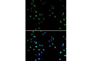 Immunofluorescence analysis of A549 cell using HDAC4 antibody.