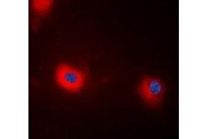 Immunofluorescent analysis of MYPT1 (pT696) staining in HEK293T cells. (PPP1R12A 抗体  (pSer696))