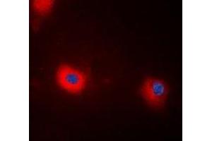 Immunofluorescent analysis of MYPT1 (pT696) staining in HEK293T cells.