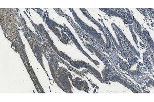IHC analysis of MAPK11 using anti-MAPK11 antibody (ABIN7600772). (MAPK11 抗体  (AA 230-364))