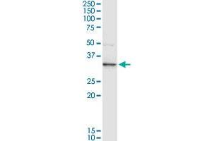 ANXA3 MaxPab rabbit polyclonal antibody. (Annexin A3 抗体  (AA 1-323))