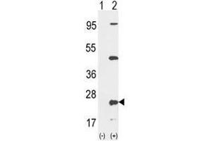 Western blot analysis of PTP4A2 (arrow) using rabbit polyclonal PTP4A2 Antibody (Center) . (PTP4A2 抗体  (Middle Region))