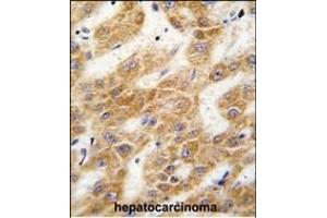 Immunohistochemistry (Paraffin-embedded Sections) (IHC (p)) image for anti-Aldehyde Dehydrogenase 4 Family, Member A1 (ALDH4A1) (AA 533-561), (C-Term) antibody (ABIN392356)