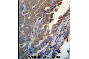 Immunohistochemistry (Paraffin-embedded Sections) (IHC (p)) image for anti-Ankyrin Repeat and SOCS Box Containing 4 (ASB4) (AA 226-255), (C-Term) antibody (ABIN657170)